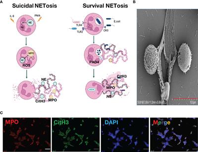 Impact of Neutrophil Extracellular Traps on Thrombosis Formation: New Findings and Future Perspective